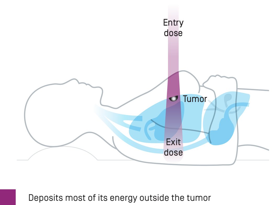 proton-based-radiotherapy.jpg