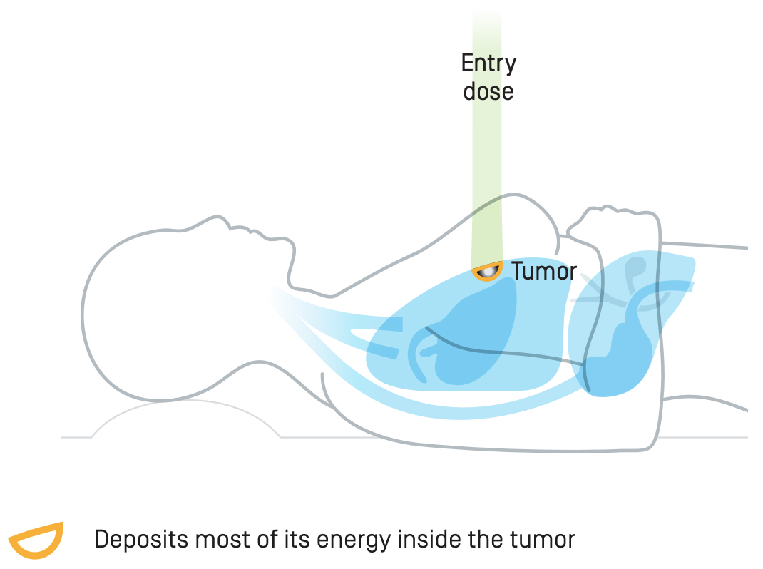 Proton Therapy